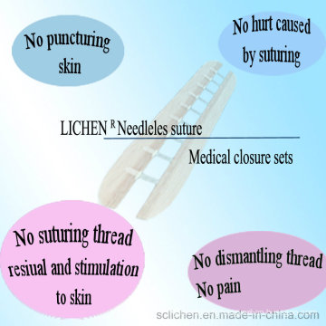 Suture chirurgicale sans aiguilles Équipement médical jetable